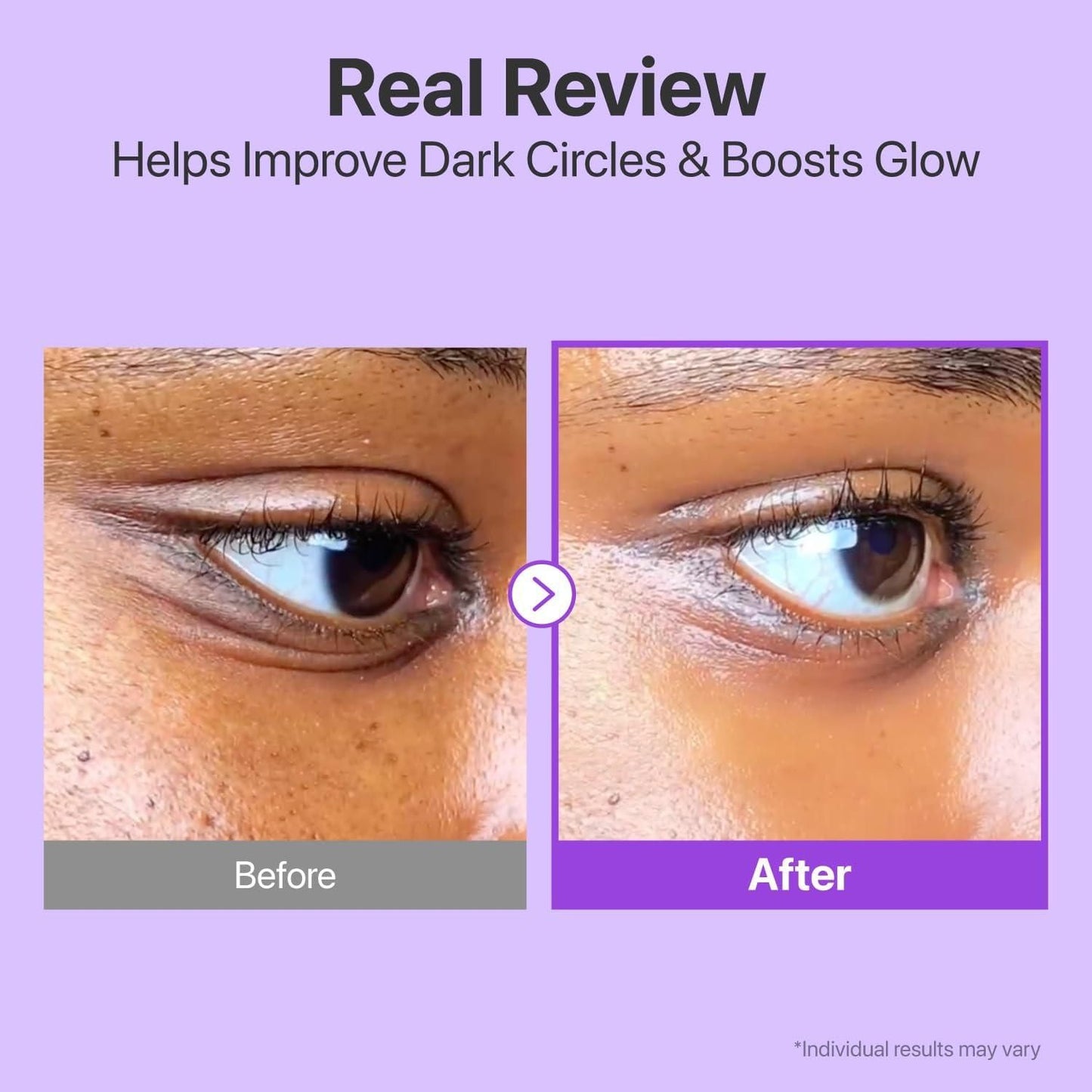 NAD+ Retinol Volumetox Eye Cream - 100g