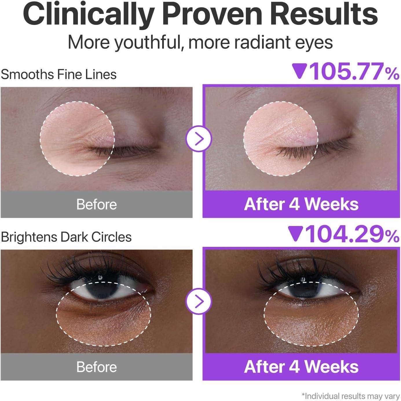 NAD+ Retinol Volumetox Eye Cream - 100g