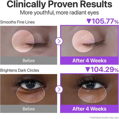 NAD+ Retinol Volumetox Eye Cream - 100g